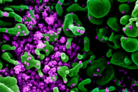  Científicos japoneses identifican el virus Yezo, un nairovirus que provoca fiebre y reduce las plaquetas