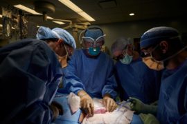  Trasplantado con éxito un riñón de cerdo a una mujer en muerte cerebral