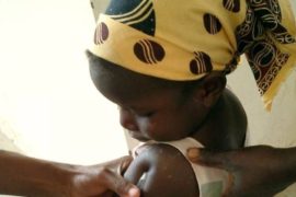  La OMS aprueba el uso de la vacuna de la malaria en niños