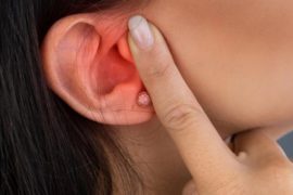  ¿Qué es la otitis? Estos son sus síntomas, las causas y su tratamiento