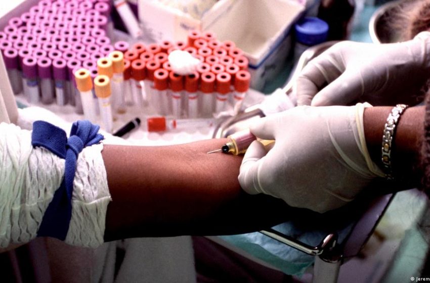  Nuevos casos por infección de VIH se registran en Los Santos