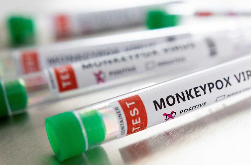  Minsa extiende uso de vacuna contra la Viruela del Mono