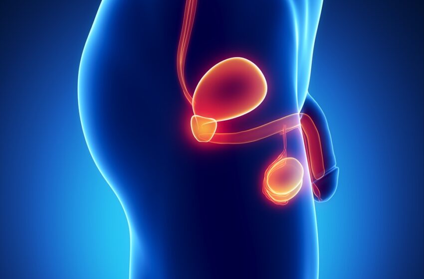 Rompiendo mitos: El cáncer de próstata no solo es una enfermedad de hombres mayores